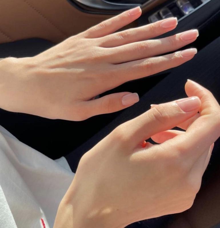 6 bất thường ở bàn tay đang ám chỉ lượng đường trong máu vượt ngưỡng an toàn, tiếc là rất ít người để ý!- Ảnh 1.