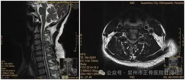 Người phụ nữ liệt nửa người vì trở mình lấy điện thoại giữa đêm: Đừng xem nhẹ những dấu hiệu cảnh báo này- Ảnh 2.
