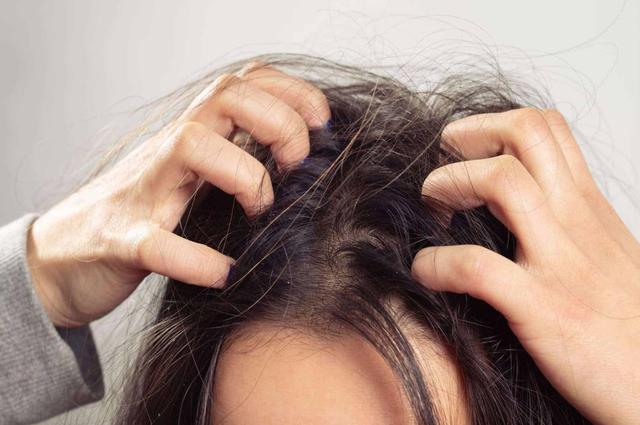 “Cái tóc là góc con người” - tóc thay đổi theo 5 kiểu này đồng nghĩa cơ thể đang mắc bệnh, ai cũng nên biết để phòng và sống thọ- Ảnh 4.