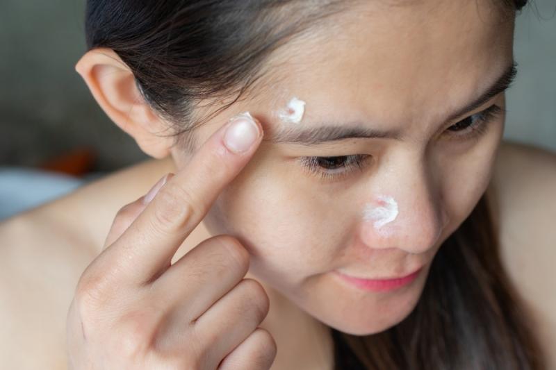 5 thứ KHÔNG BAO GIỜ được bôi lên mặt vì tàn phá làn da: Bất ngờ khi nhiều chị em tưởng đó là mẹo làm đẹp- Ảnh 2.