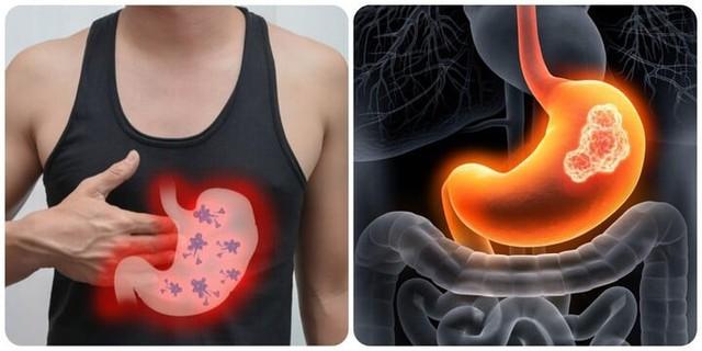 Không phải ngẫu nhiên mà nhiều gia đình liên tiếp có người mắc ung thư: Đây là 6 bệnh ung thư có tính di truyền rõ rệt- Ảnh 3.