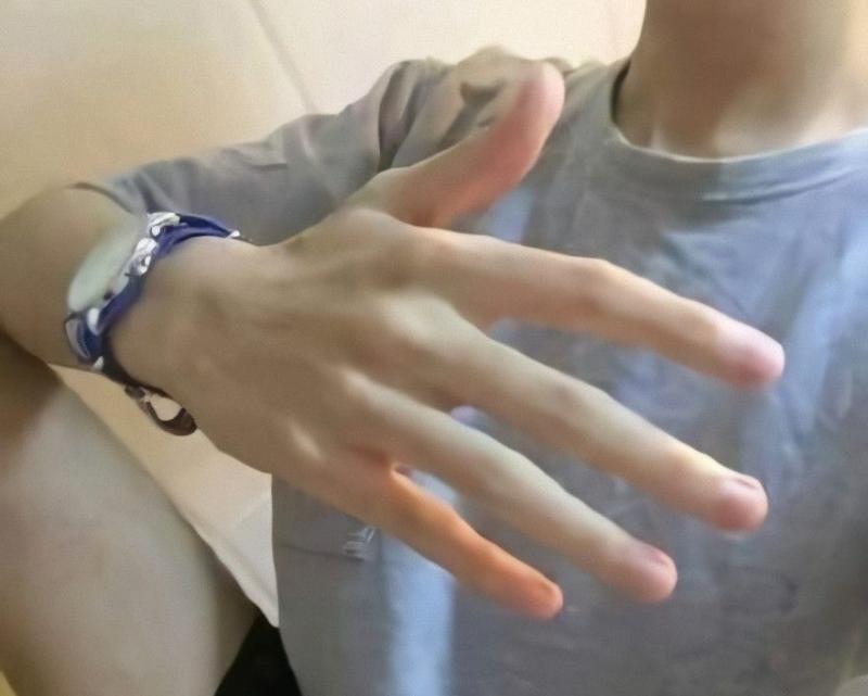 “3 to, 2 trắng” thường xuất hiện ở nam giới có tuổi thọ ngắn, không có cái nào thì quả là may mắn!- Ảnh 3.