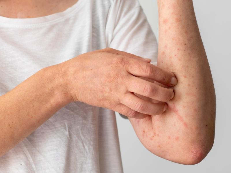 Buổi tối thấy 5 dấu hiệu này, cẩn thận kẻo gan đang suy hỏng: Khoa học đã chứng minh- Ảnh 3.