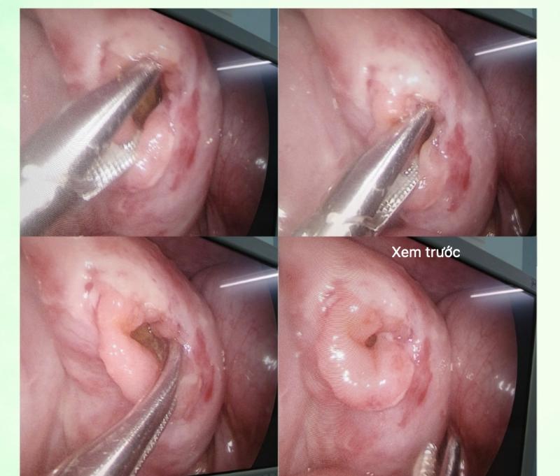 Chạy xe đạp điện tông ô tô đang đậu, bé trai 6 tuổi vỡ ruột- Ảnh 1.
