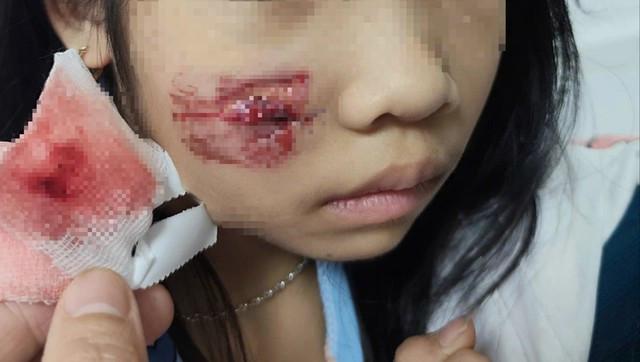 Cháu bé bị khỉ hoang tấn công khi chơi ở sân nhà- Ảnh 1.