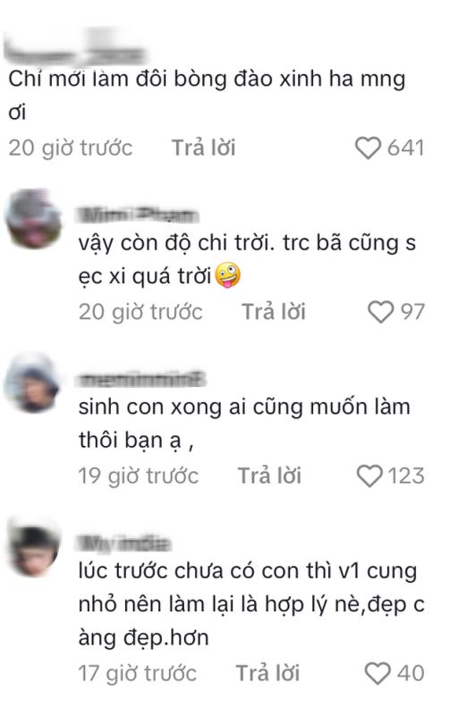 Bảo Anh mới thẩm mỹ?- Ảnh 4.