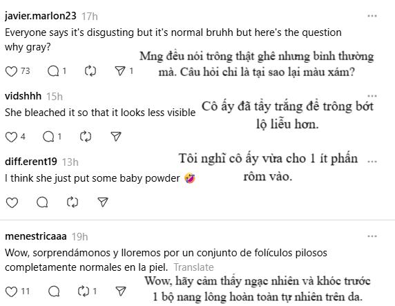 Nữ ca sĩ khoe lông nách trắng xoá, dân tình tranh cãi nảy lửa- Ảnh 4.