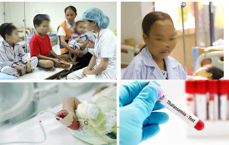 Hơn 13% người Việt mang gen bệnh tan máu bẩm sinh- Ảnh 1.