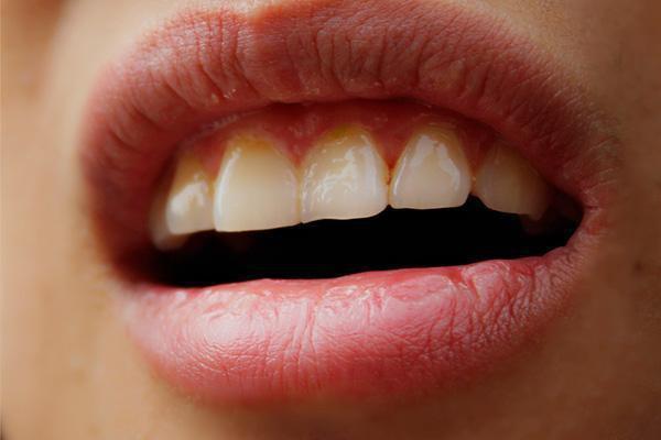 Nhận biết bệnh gan qua giấc ngủ: Những người có vấn đề về gan thường xuất hiện 3 triệu chứng vào ban đêm- Ảnh 3.