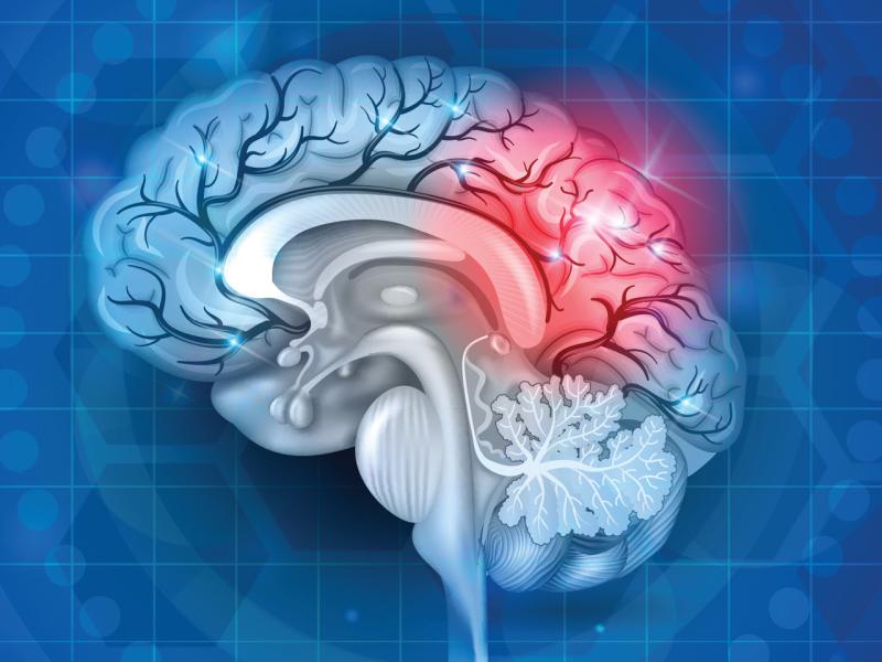 Ngày càng có nhiều người bị đột quỵ: Chuyên gia gọi tên 10 “thủ phạm” hàng đầu- Ảnh 1.