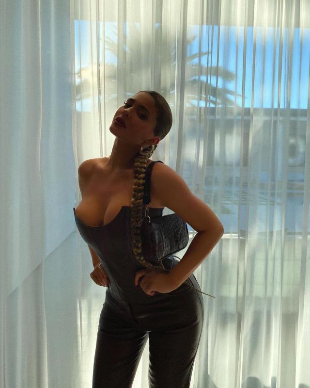Kylie Jenner đang phải chữa bệnh gì?- Ảnh 1.