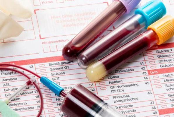 Sau những trường hợp ĐỘT TỬ hay ĐỘT QUỴ: BS nói đây là những gì người đang chơi thể thao cần làm để bảo vệ mình- Ảnh 4.