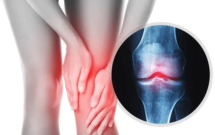 Trời lạnh, đau cơ xương khớp tăng: Chủ động chăm sóc để giảm đau- Ảnh 1.