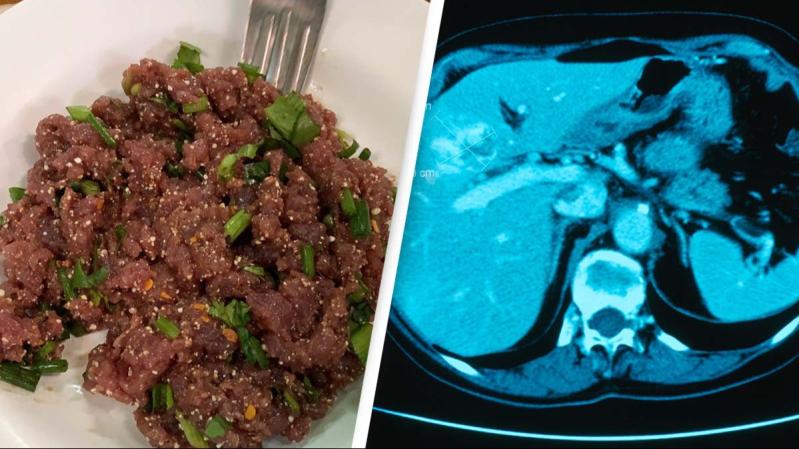 Món ăn chế biến từ cá "dẫn lối" cho ung thư: Thích tới mấy cũng phải dè chừng- Ảnh 3.