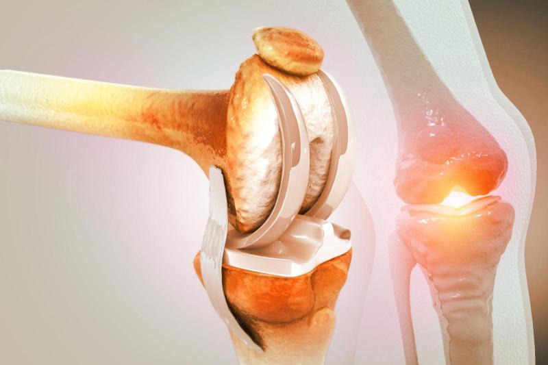 4 loại thực phẩm "ăn mòn" khớp nhanh nhất nếu lạm dụng: Toàn món khoái khẩu của nhiều người- Ảnh 1.