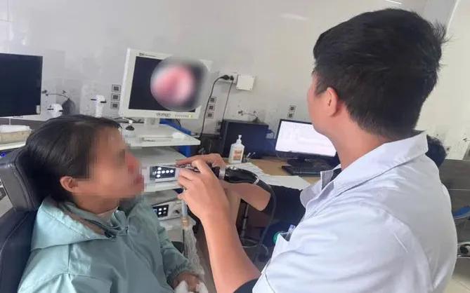 Cảnh giác với viêm nấm xoang mũi- Ảnh 1.