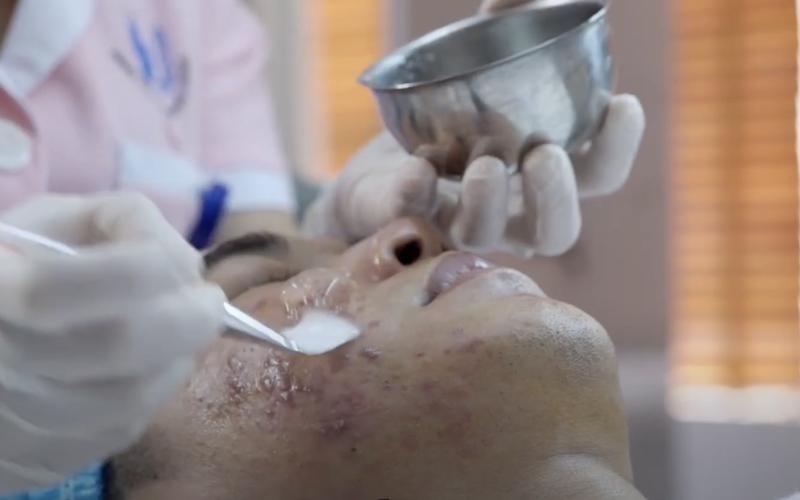 Không chuẩn bị đủ những điều này, bác sĩ khuyên đừng phẫu thuật thẩm mỹ- Ảnh 3.