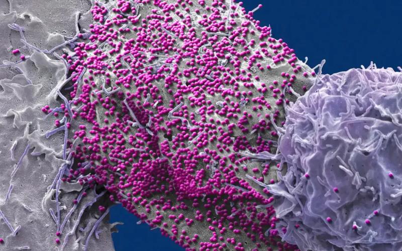 Một tế bào của người bị nhiễm HIV (Ảnh: Science Photo Library)