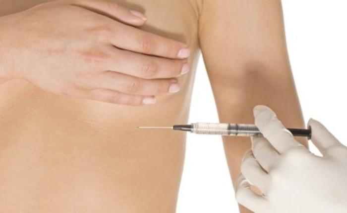 Tiêm filler nâng ngực đón Tết, người phụ nữ nhập viện vì áp xe nặng- Ảnh 1.