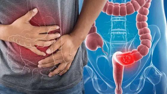 Không phải ngẫu nhiên mà nhiều gia đình liên tiếp có người mắc ung thư: Đây là 6 bệnh ung thư có tính di truyền rõ rệt- Ảnh 2.