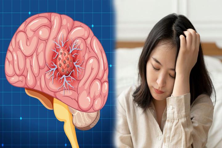 Đau đầu tưởng tiền đình nhưng có thể là 'chỉ điểm' của bệnh trọng- Ảnh 1.