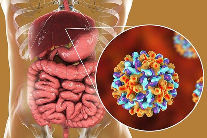 4 bệnh tưởng chừng lành tính nhưng có thể là tiền thân của ung thư- Ảnh 1.