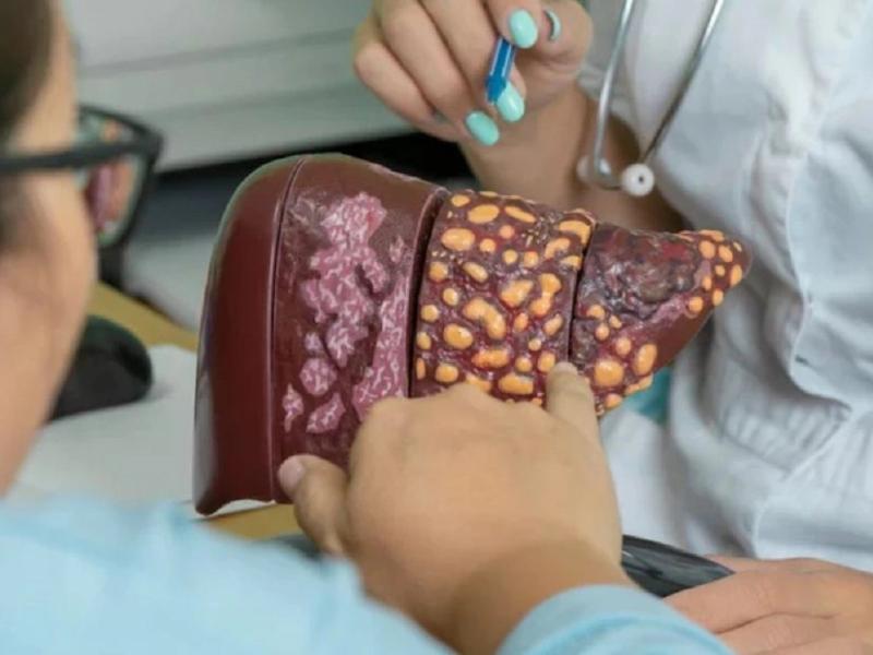 Không phải thể dục, chỉ cần 1 thay đổi trong lối sống có thể giảm 48% nguy cơ gan nhiễm mỡ, bệnh tim mạch và tử vong sớm- Ảnh 1.