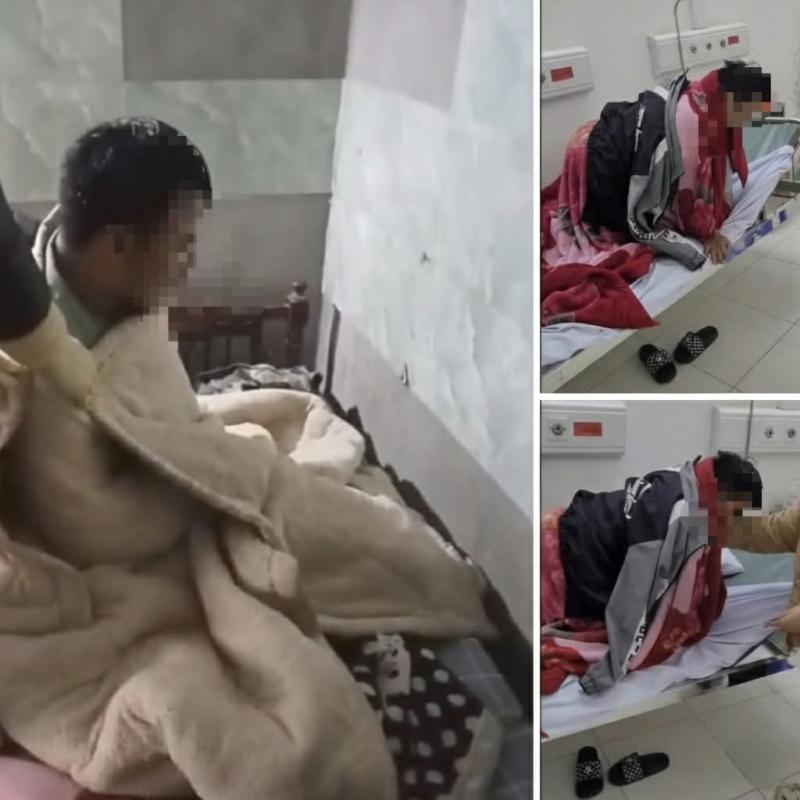 Lào Cai: Một xã có ba người nghi bị chó dại cắn, một trường hợp đã tử vong- Ảnh 1.