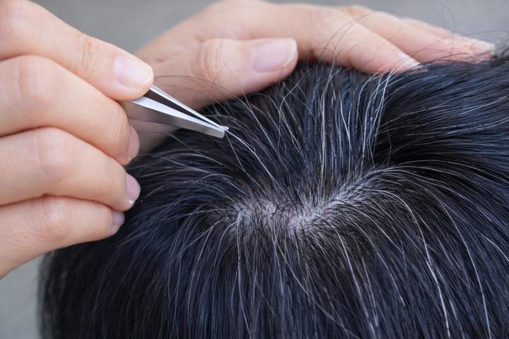 Một thói quen phổ biến ai bị tóc bạc cũng làm khiến tóc càng bạc, càng thưa- Ảnh 1.