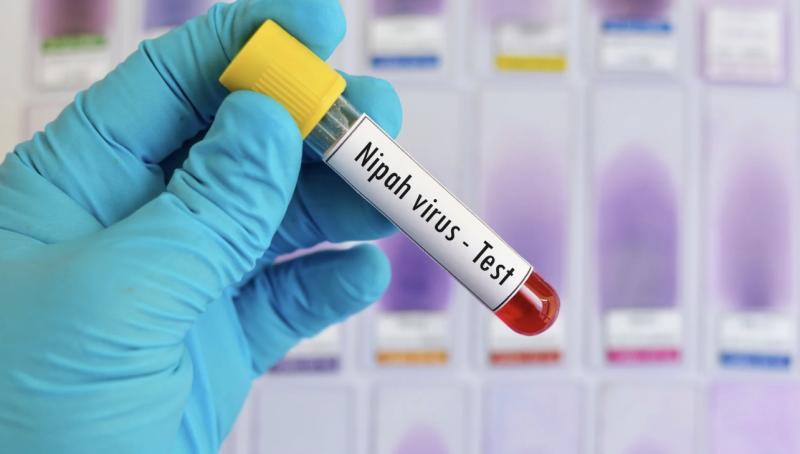 TPHCM tăng cường giám sát nhập cảnh, kiểm soát dịch bệnh Nipah- Ảnh 1.