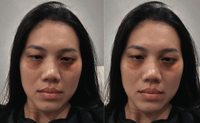 Dụi mắt không nhận ra Ánh Viên, sao lại ra nông nỗi này?- Ảnh 1.