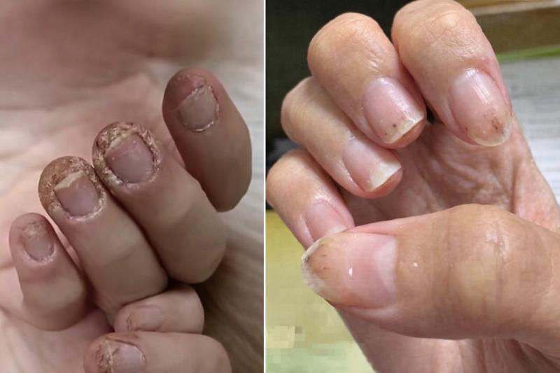 Cô gái 28 tuổi móng tay 