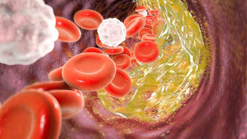 Ăn chuối đều đặn trong 6 tháng, mức cholesterol trong cơ thể biến đổi bất ngờ- Ảnh 1.