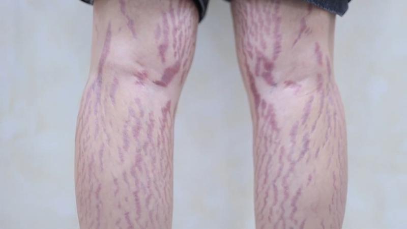 Dồn dập tai biến cao điểm làm đẹp ‘cấp tốc’ mùa Tết- Ảnh 1.