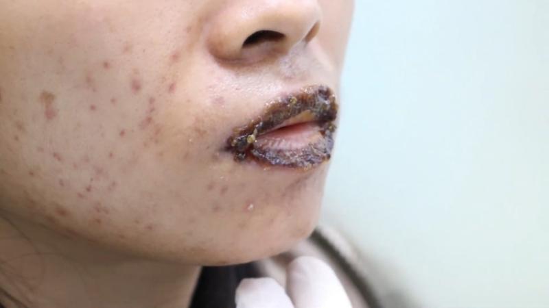 Dồn dập tai biến cao điểm làm đẹp ‘cấp tốc’ mùa Tết- Ảnh 2.