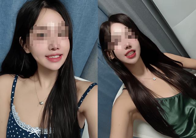 Nếu đang định thẩm mỹ răng trước Tết thì đây chắc chắn là những điều bạn cần đọc ngay- Ảnh 3.