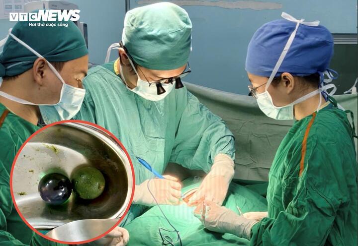 Bé gái 18 tháng tuổi nguy kịch, ruột tắc nghẽn vì nuốt hạt nở đồ chơi- Ảnh 1.