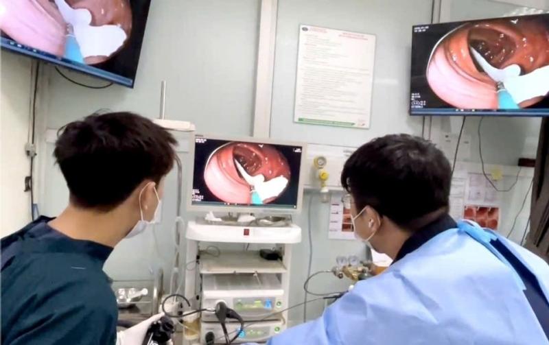 Người đàn ông 35 tuổi sốc nặng khi thấy ký sinh trùng "khổng lồ" đang sống trong ruột- Ảnh 1.