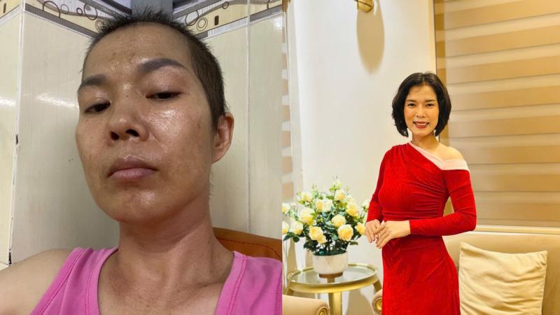 Phát hiện ung thư giai đoạn 3 đã di căn, 1 năm sau làm được điều không ai nghĩ tới: Tất cả nhờ vào 2 việc- Ảnh 1.