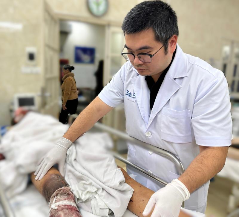 Tai nạn pháo nổ gia tăng, nhiều ca cấp cứu nguy kịch- Ảnh 2.