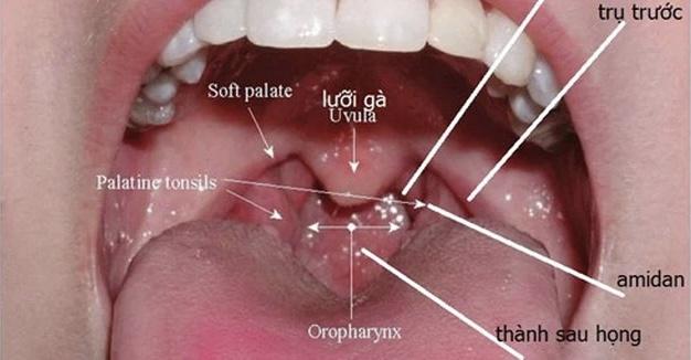 Cổ lên hạch tưởng bị viêm, người đàn ông bất ngờ phát hiện ung thư vòm họng giai đoạn 2: Các dấu hiệu hay bị xem thường- Ảnh 2.