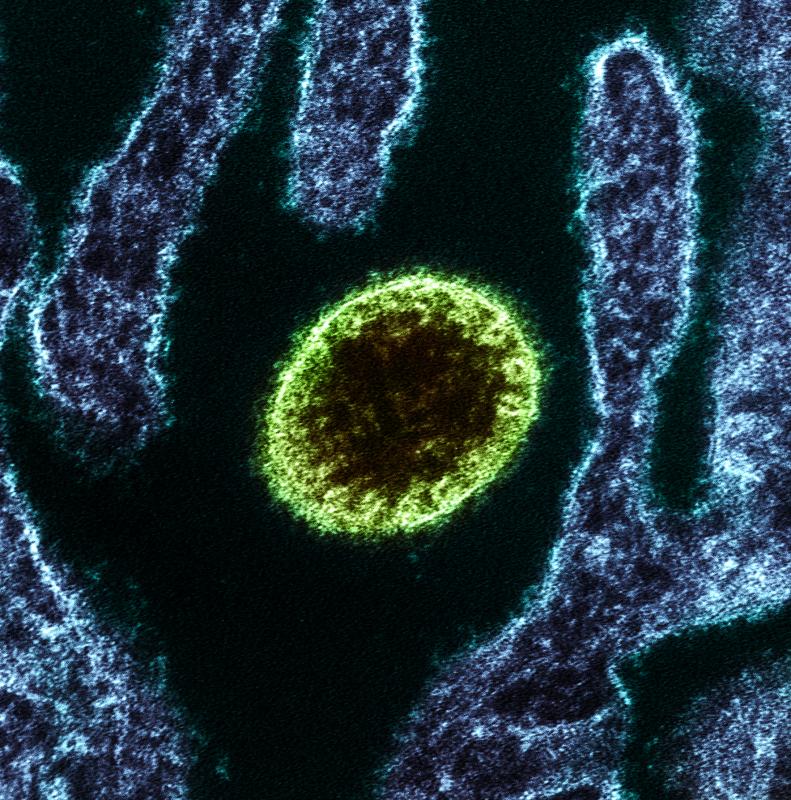 Không chỉ lây từ dơi, virus Nipah có thể truyền qua cả lợn và thịt lợn: Cảnh báo nguy cơ từ nguồn thực phẩm kém an toàn- Ảnh 4.