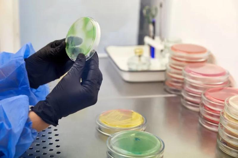 Không chỉ sữa bột, nhiều thực phẩm quen thuộc cũng có thể chứa vi khuẩn Bacillus cereus - thứ khiến Nestlé thu hồi sữa toàn cầu- Ảnh 4.
