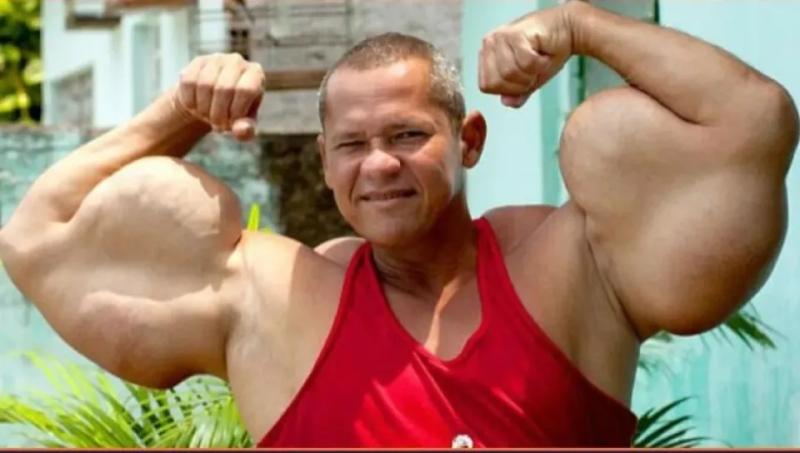 "Quái vật thể hình" Brazil sở hữu chu vi bắp tay lên tới 74cm đột ngột qua đời, bác sĩ cảnh báo 1 vấn đề sức khỏe tiềm ẩn- Ảnh 1.