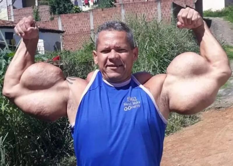 "Quái vật thể hình" Brazil sở hữu chu vi bắp tay lên tới 74cm đột ngột qua đời, bác sĩ cảnh báo 1 vấn đề sức khỏe tiềm ẩn- Ảnh 4.