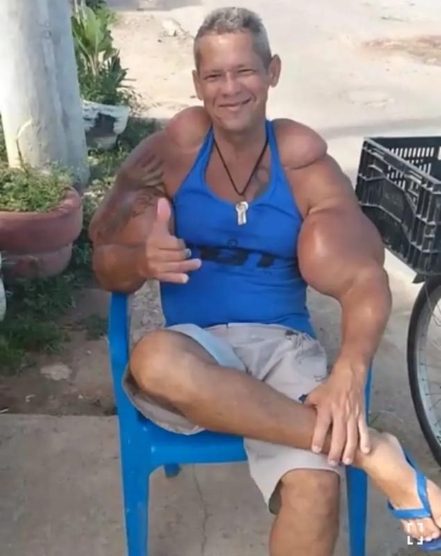 "Quái vật thể hình" Brazil sở hữu chu vi bắp tay lên tới 74cm đột ngột qua đời, bác sĩ cảnh báo 1 vấn đề sức khỏe tiềm ẩn- Ảnh 5.
