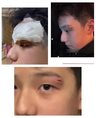Một nữ diễn viên nổi tiếng làm 1 việc khiến con trai phải khâu tới 4 mũi- Ảnh 1.