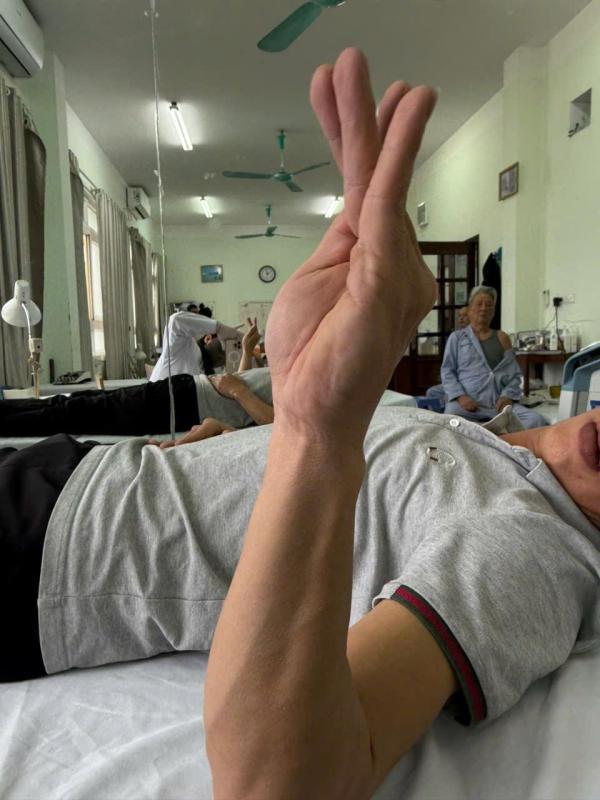 Ngủ gật 30 phút trong giờ làm, người đàn ông 37 tuổi bỗng liệt dây thần kinh, không nhấc nổi cổ tay- Ảnh 1.