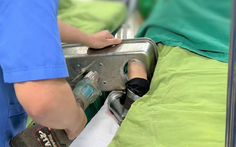 Cấp cứu bệnh nhân mắc kẹt tay trong máy xay thịt- Ảnh 1.