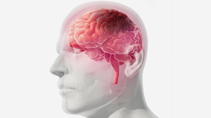 Bị đột quỵ và liệt nửa người vĩnh viễn, người phụ nữ hối hận vì đã bỏ qua 1 dấu hiệu kéo dài trong 3 ngày- Ảnh 2.